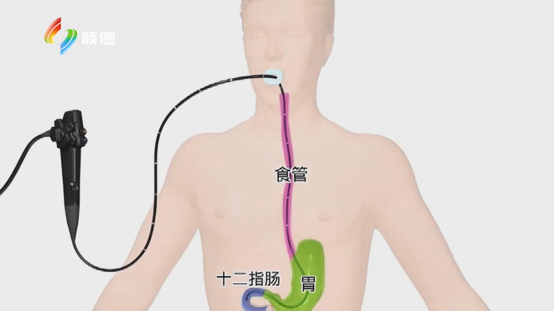 消化系统的“防癌密码” 你解锁了吗？